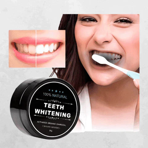 Blanqueador Dental™ Teeth Whitening